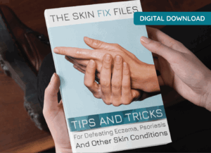 The Skin Fix Files